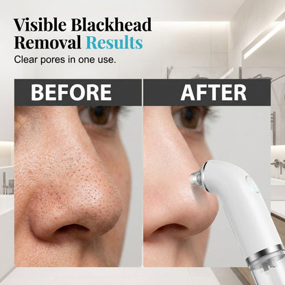 Electric facial cleanser · Lifting and firming · Deep pore cleansing