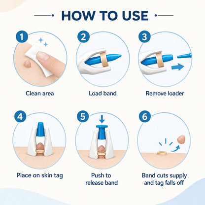 🧴 Natural Skin Tag Remover Kit