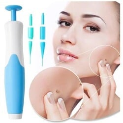 🧴 Natural Skin Tag Remover Kit