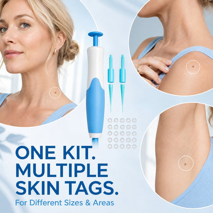 🧴 Natural Skin Tag Remover Kit