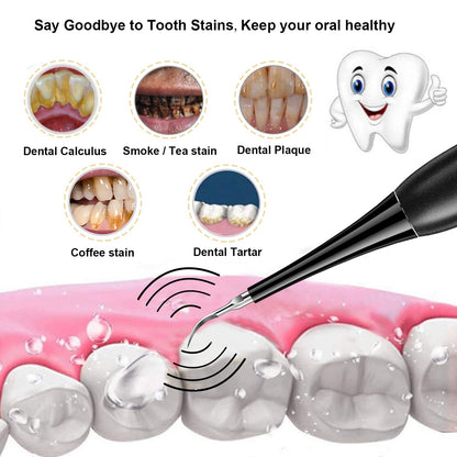 Ideal Gift - Electric Teeth Cleaner