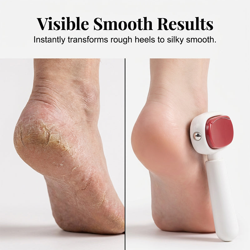 📢📢50% OFF !! ⏰Double-Sided Foot Scraper for Callus Removal